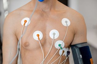 Holter EKG – całodobowa diagnostyka pracy serca. Jak wygląda badanie i co pokazuje?
